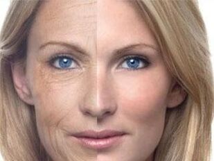 Pigmentación da pel