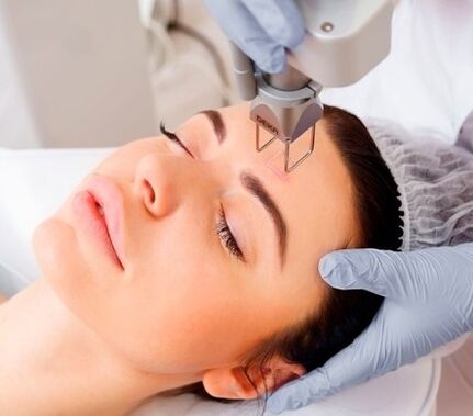 a esencia do procedemento de rexuvenecemento da pel facial con láser fraccionado