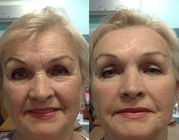 experiencia de usar crema antiarrugas Goji Cream foto persoal antes e despois